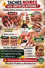Charger l'image dans la galerie, ✨ Élimine quintos, mamies et taches sombres