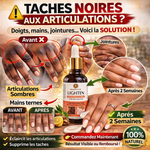 Charger l'image dans la galerie, ✨ Élimine quintos, mamies et taches sombres