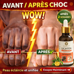 Charger l'image dans la galerie, ✨ Élimine quintos, mamies et taches sombres
