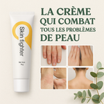 Charger l'image dans la galerie, Skin Fighter – La Crème Qui Combat Tous démangeaisons, rougeurs, mycoses et irritations !