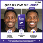 Charger l'image dans la galerie, Pro Strips ™ - 🦷 Retrouvez un sourire plus blanc, éclatant et plein de confiance
