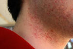 Charger l'image dans la galerie, Skin Fighter – La Crème Qui Combat Tous démangeaisons, rougeurs, mycoses et irritations !