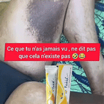 Charger l'image dans la galerie, Fevicid Crème – Anti-Mycoses, Tâches Noires et Boutons de Rasage | Résultats rapides et visibles
