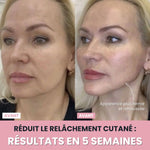 Charger l'image dans la galerie, Sculpteur facial LED 7 en 1 |
