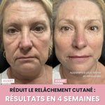 Charger l'image dans la galerie, Sculpteur facial LED 7 en 1 |
