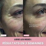 Charger l'image dans la galerie, Sculpteur facial LED 7 en 1 |
