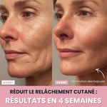 Charger l'image dans la galerie, Sculpteur facial LED 7 en 1 |
