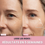 Charger l'image dans la galerie, Sculpteur facial LED 7 en 1 |

