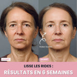 Charger l'image dans la galerie, Sculpteur facial LED 7 en 1 |
