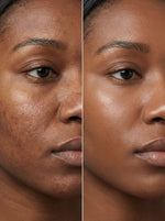 Charger l'image dans la galerie, KOJIC SERUM — LA SOLUTION POUR UNE PEAU PLUS UNIFORME
