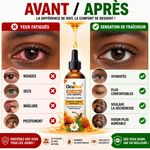 Charger l'image dans la galerie, OcuBee™ – Hydrate, apaise et rafraîchit vos yeux fatigués | Sensation de confort dès les premières utilisations | Satisfait ou remboursé
