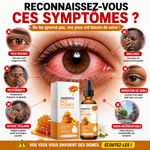 Charger l'image dans la galerie, OcuBee™ – Hydrate, apaise et rafraîchit vos yeux fatigués | Sensation de confort dès les premières utilisations | Satisfait ou remboursé

