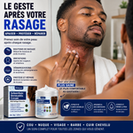 Charger l'image dans la galerie, DERMA CLEAN™ – Crème Apaisante &amp; Anti-Irritations
