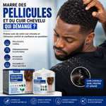 Charger l'image dans la galerie, DERMA CLEAN™ – Crème Apaisante &amp; Anti-Irritations
