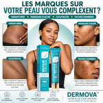 Charger l'image dans la galerie, DERMOVA™ Crème Réparatrice pour Vergetures, Marques d’Acné, Cicatrices &amp; Taches Sombres
