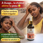 Charger l'image dans la galerie, ✨ Élimine quintos, mamies et taches sombres
