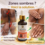 Charger l'image dans la galerie, ✨ Élimine quintos, mamies et taches sombres
