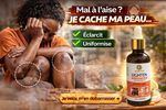 Charger l'image dans la galerie, ✨ Élimine quintos, mamies et taches sombres
