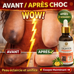 Charger l'image dans la galerie, ✨ Élimine quintos, mamies et taches sombres
