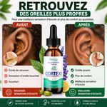 Charger l'image dans la galerie, AudiPure™- Bourdonnements, oreilles bouchées, difficulté à entendre ? Prenez soin de votre audition dès aujourd'hui.
