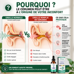 Charger l'image dans la galerie, AudiPure™- Bourdonnements, oreilles bouchées, difficulté à entendre ? Prenez soin de votre audition dès aujourd'hui.
