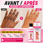 Charger l'image dans la galerie, 🧴 Huile Peeling Anti-Taches &amp; Vergetures

