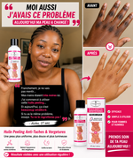 Charger l'image dans la galerie, 🧴 Huile Peeling Anti-Taches &amp; Vergetures
