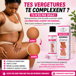 Charger l'image dans la galerie, 🧴 Huile Peeling Anti-Taches &amp; Vergetures
