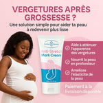 Charger l'image dans la galerie, Crème Anti-Vergetures Intense – Peau Plus Lisse &amp; Plus Uniforme
