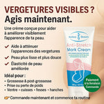 Charger l'image dans la galerie, Crème Anti-Vergetures Intense – Peau Plus Lisse &amp; Plus Uniforme
