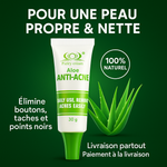 Charger l'image dans la galerie, 🌿 Crème Anti-Acné Aloe – Dites Adieu aux Boutons, Taches &amp; Points Noirs Dès 7 Jours 🌿
