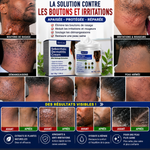 Charger l'image dans la galerie, DERMA CLEAN™ – Crème Apaisante &amp; Anti-Irritations
