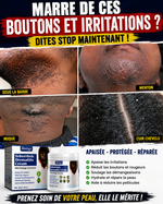 Charger l'image dans la galerie, DERMA CLEAN™ – Crème Apaisante &amp; Anti-Irritations
