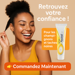 Charger l'image dans la galerie, Fevicid Crème – Anti-Mycoses, Tâches Noires et Boutons de Rasage
