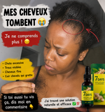 Charger l'image dans la galerie, Sérum de croissance des cheveux 7 jours
