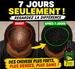 Charger l'image dans la galerie, Sérum de croissance des cheveux 7 jours
