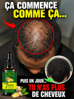 Charger l'image dans la galerie, Sérum de croissance des cheveux 7 jours
