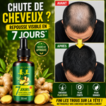 Charger l'image dans la galerie, Sérum de croissance des cheveux 7 jours
