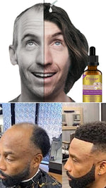 Charger l'image dans la galerie, Retrouver leurs cheveux en un temps records.
