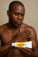 Charger l'image dans la galerie, Skin Fighter – La Crème Qui Combat Tous  démangeaisons, rougeurs, mycoses et irritations !
