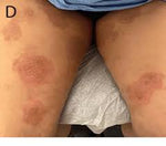 Charger l'image dans la galerie, Skin Fighter – La Crème Qui Combat Tous  démangeaisons, rougeurs, mycoses et irritations !
